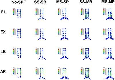 Biomechanical evaluation of multiple pelvic screws and multirod construct for the augmentation of lumbosacral junction in long spinal fusion surgery